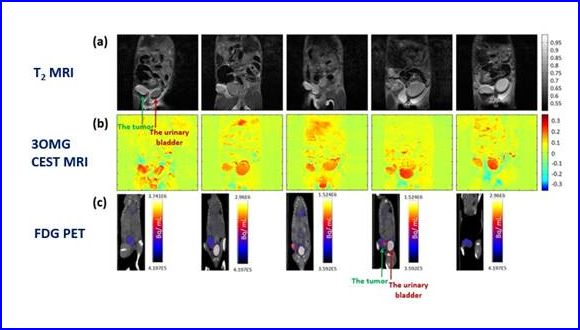 Molecular imaging of tumors by chemical exchange saturation transfer MRI of glucose analogs